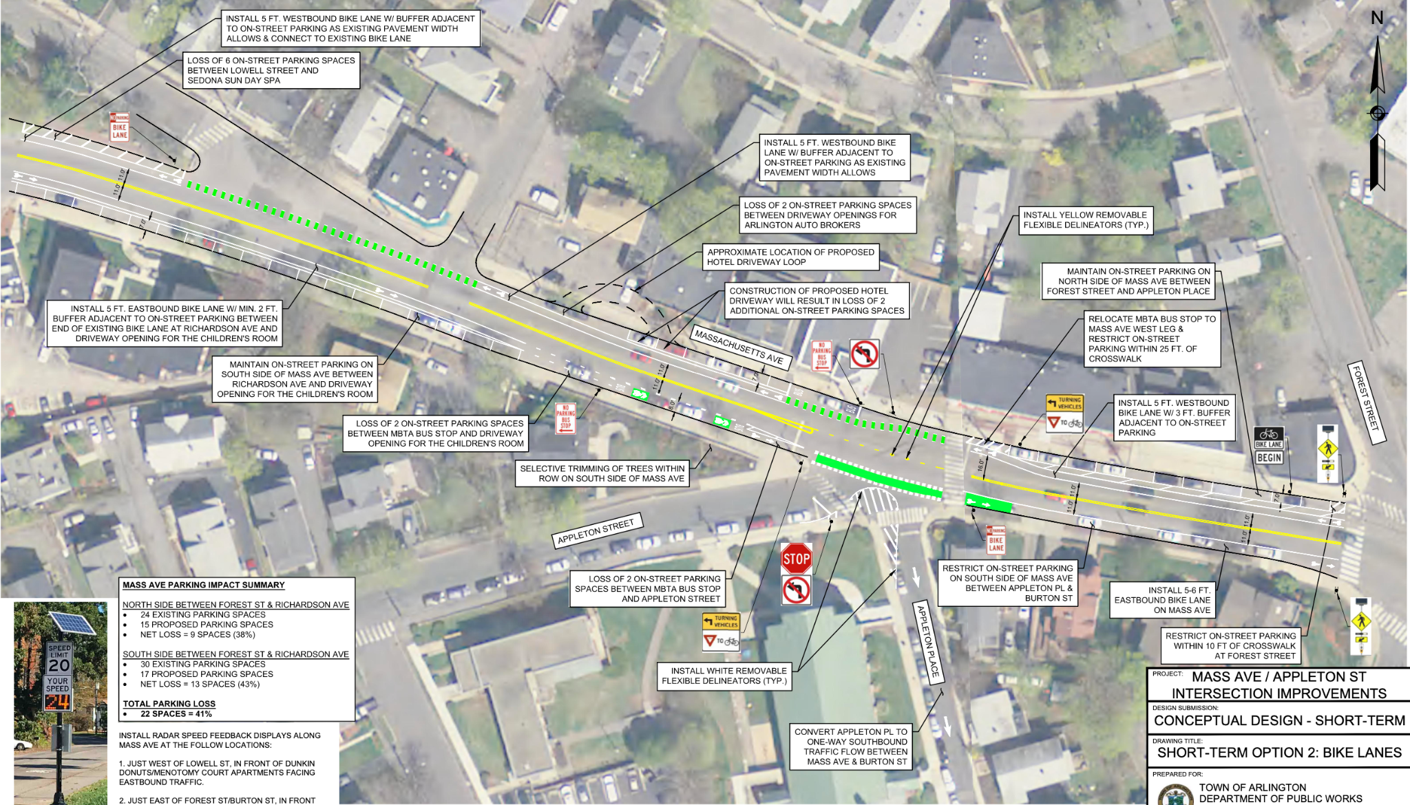 A town committee endorsed this plan, “option two,” which would have installed new bike lanes on Massachusetts Ave. near Appleton Street in Arlington.
